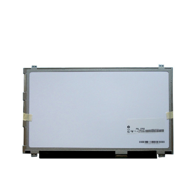 Novo ecrã LCD de 15,6 polegadas B156XW03 V1 para AUO