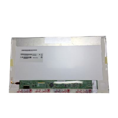 B156HB01 V0 AUO 1920 (RGB) ×1080 tela do lcd do portátil de 15,6 polegadas